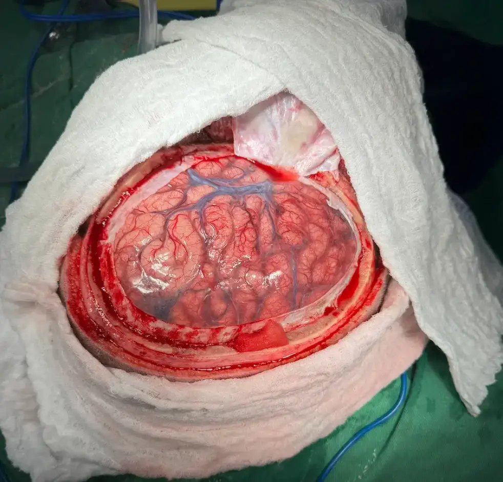Trauma craneal — foto 2