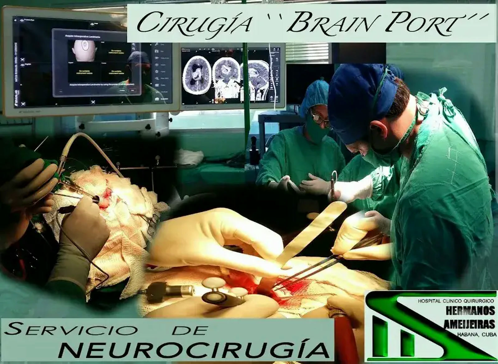 Servicio de Neurocirugía · Hospital Hermanos Ameijeiras, La Habana.
