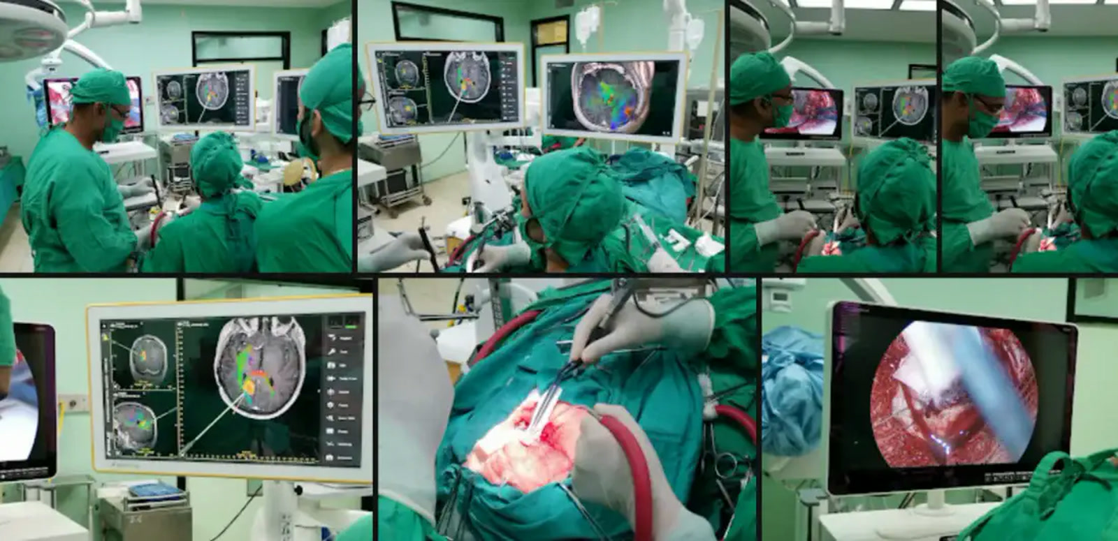 Cirugía Brain Port